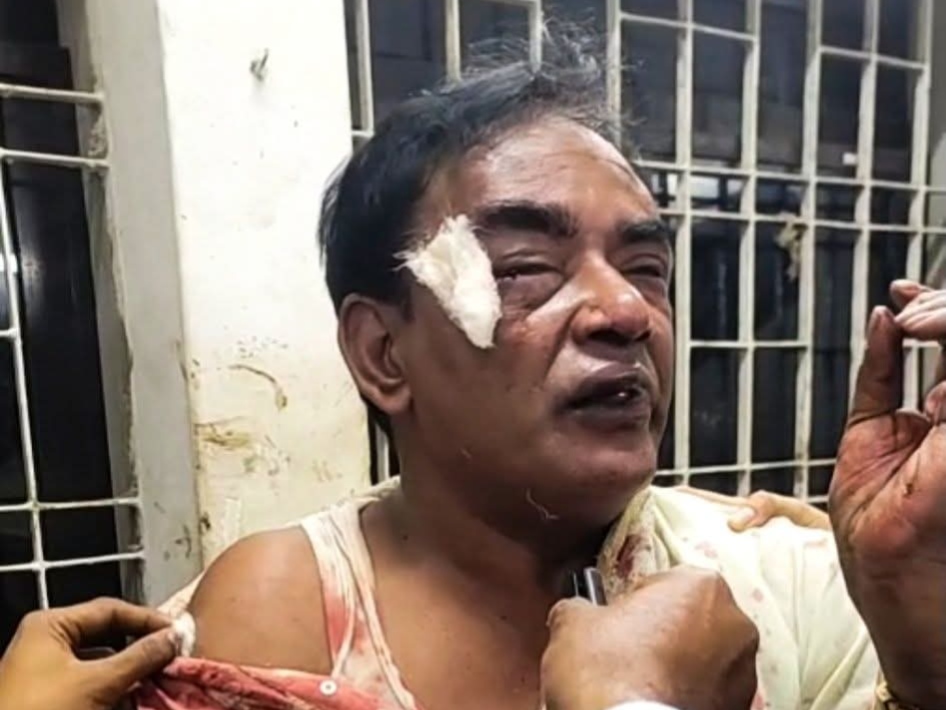 টঙ্গীতে মাদকবিরোধী প্রতিবাদে হামলা, বিএনপি কর্মী মানিক গুরুতর আহত