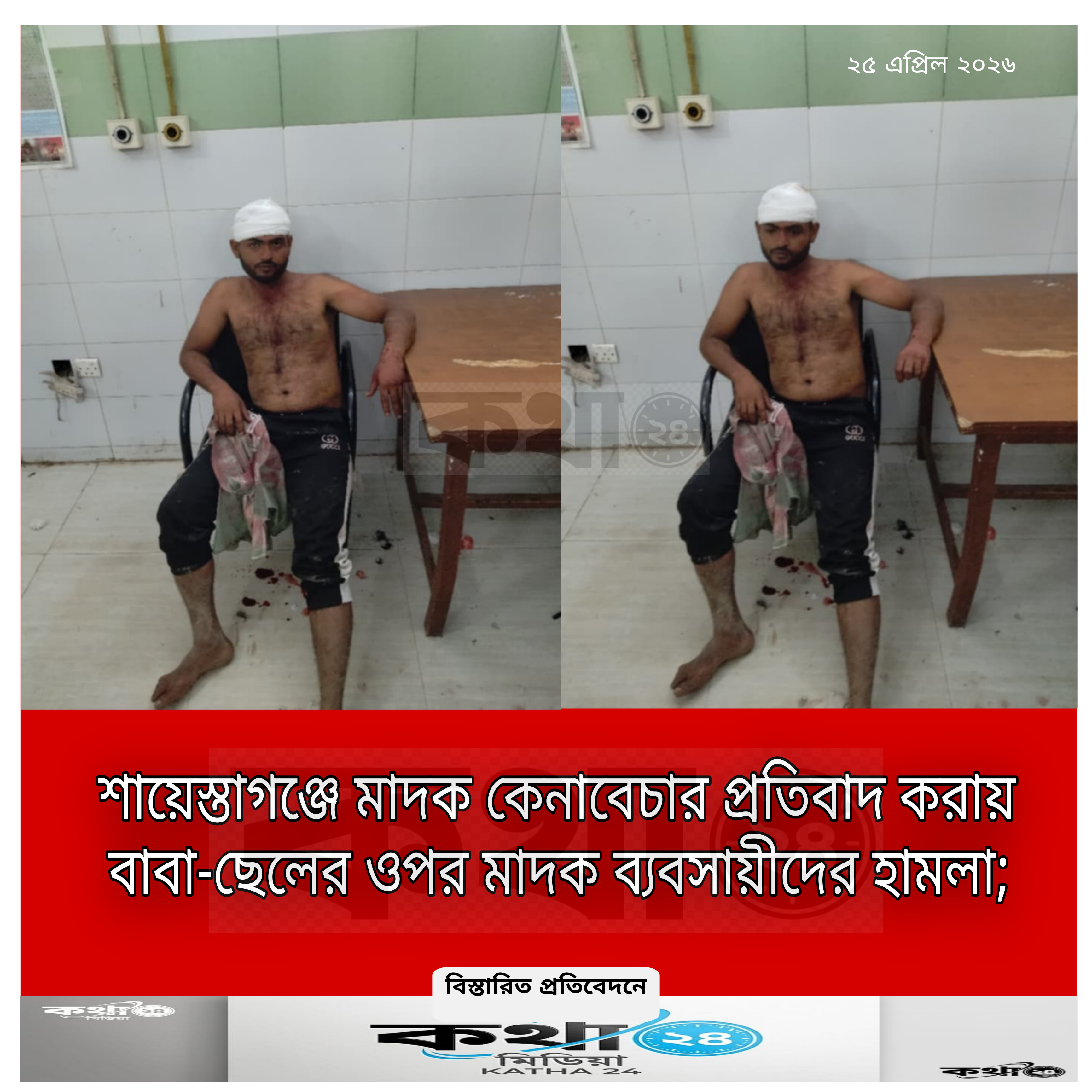 শায়েস্তাগঞ্জে মাদক ব্যবসায়ীদের বর্বরোচিত হামলা:  পুলিশের অব্যবস্থাপনার অভিযোগ